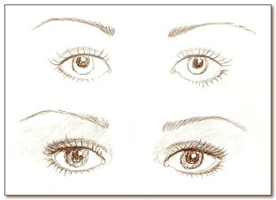 akių korekcija